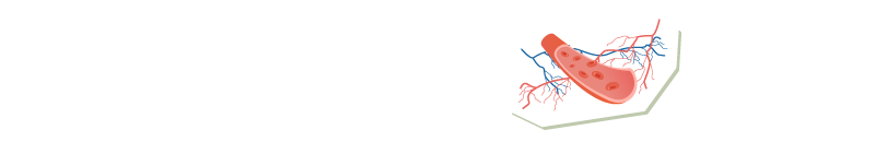 血管がつまったら大変！