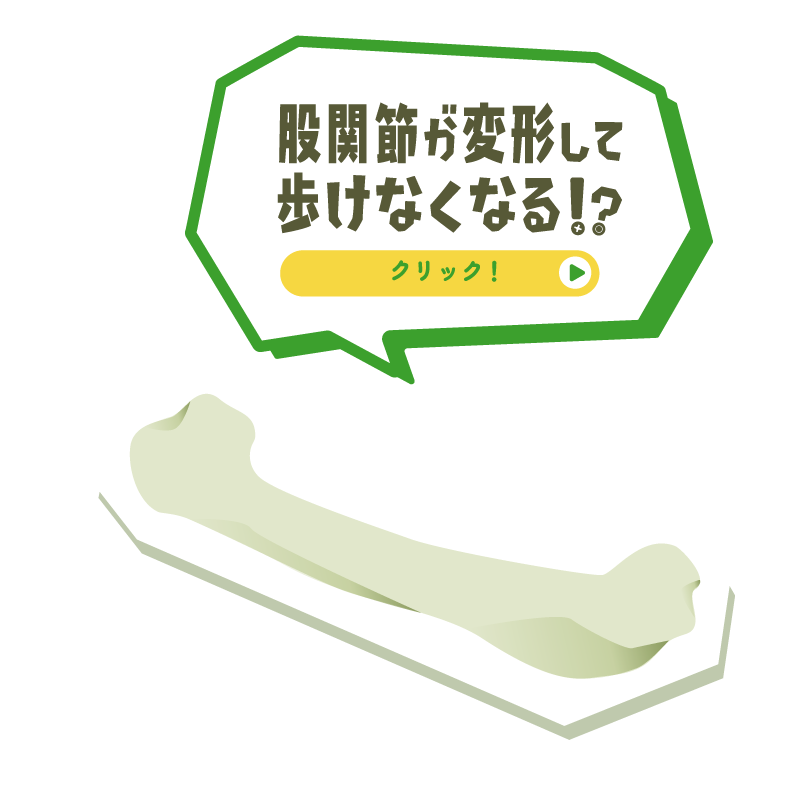 股関節が変形して歩けなくなる!?