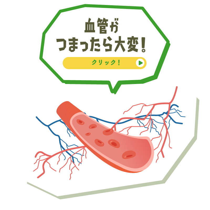 血管がつまったら大変！
